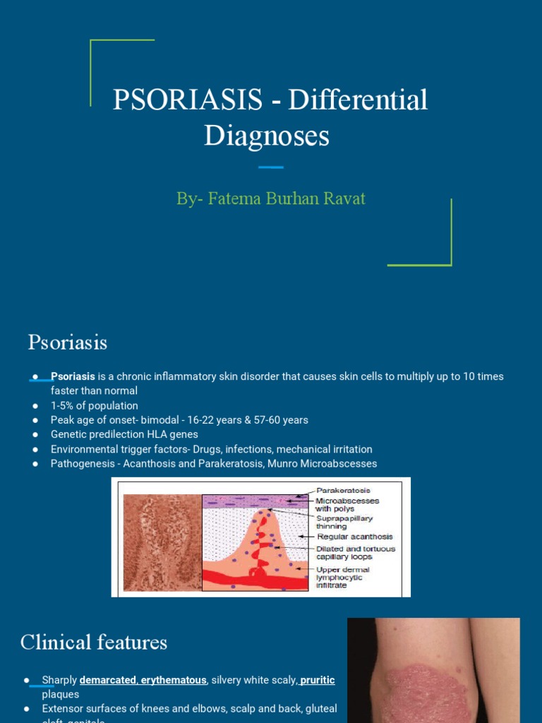 PSORIASIS Differential Diagnoses PDF