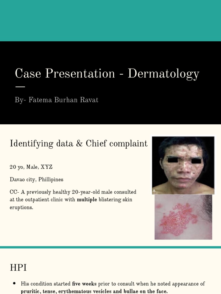 Case Presentation | PDF | Medical Specialties | Clinical Medicine