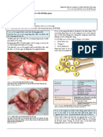 Khối u lành tính ở tử cung PDF