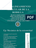 Mal Alineamiento Articular de La Rodilla