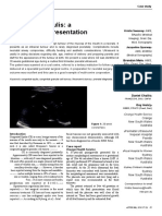 Congenital Epulis: A Clinical Case Presentation: Bsc. Grad. Dip. Med. Sonography