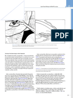 Combined Cataract Implant and Filtering (1) (13-23) .En - Id