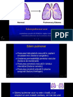 Edemul pulmonar