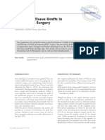 Connective tissue grafts overview