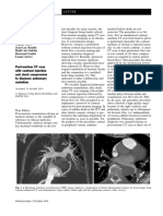 Post-mortem CT scan with contrast injection and chest compression to diagnose pulmonary embolism (1)