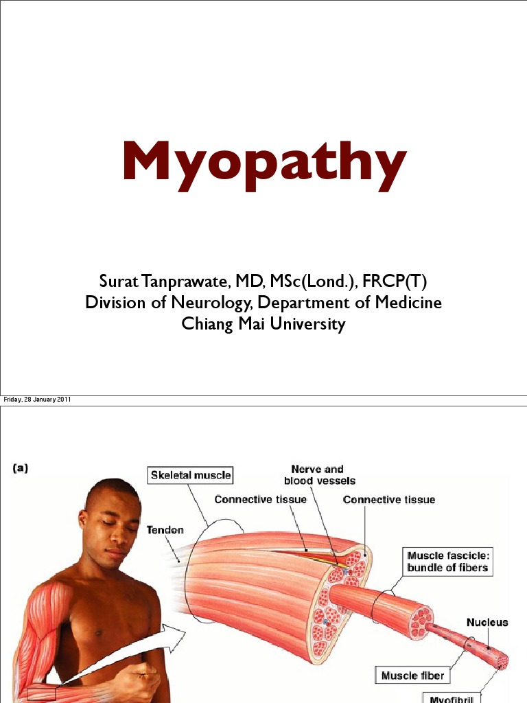 Unlocking Myopathy The Meaning Of Pathy - o3vc2u8