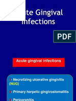 Acute Gingival Infection Lecture - pdf-1251132185