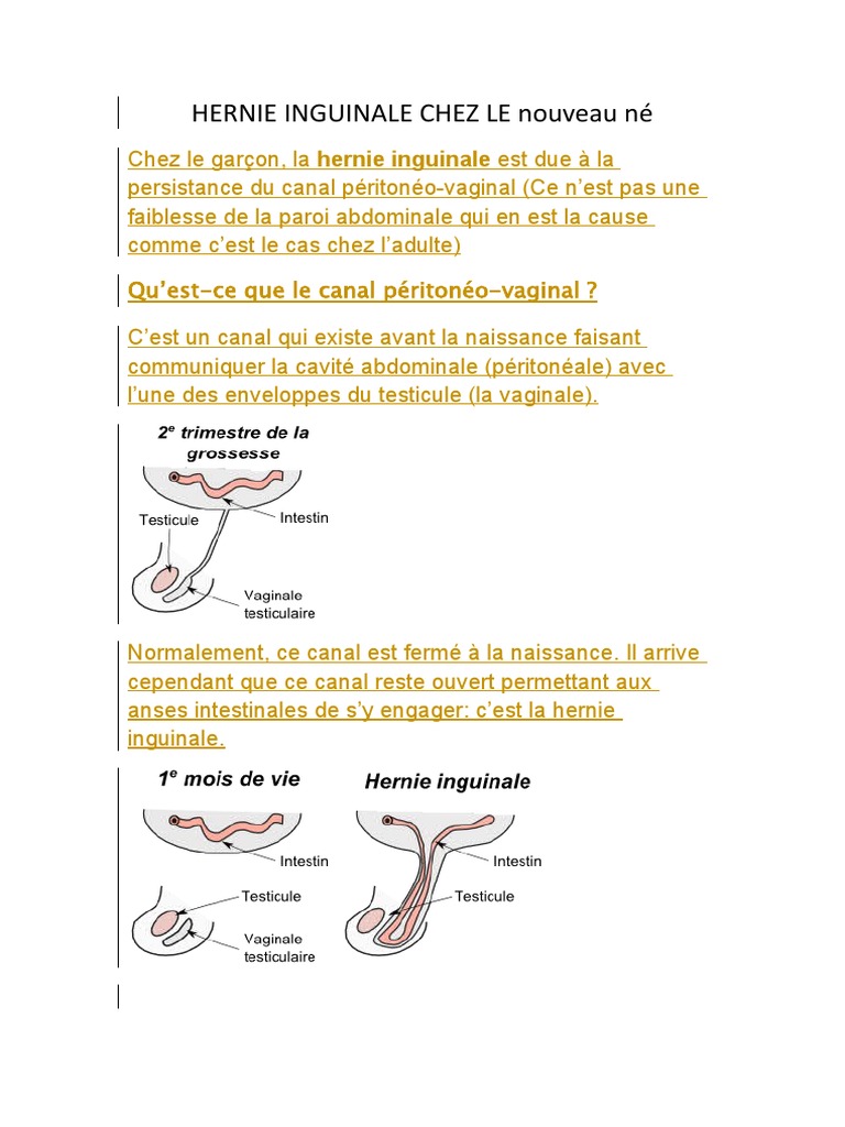 Hernie Inguinale Chez Le Garcon Rtt Sciences De La Sante