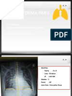 Esy - Edema Paru