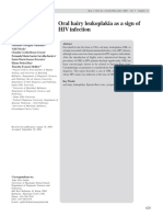 Oral Hairy Leukoplakia As A Sign of HIV Infection