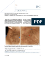 Pityriasis Versicolor On Becker's Nevus: Letterto The Editor