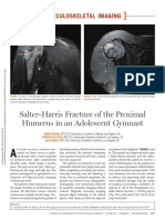 Salter-Harris Fracture of The Proximal Humerus in An Adolescent Gymnast