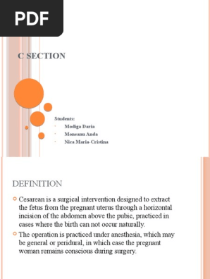 C Section