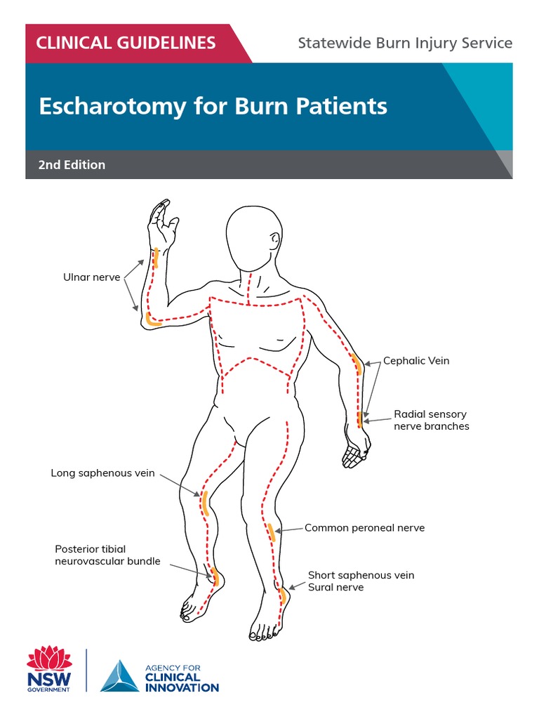 Escharotomy For Burn Patients PDF Health Care Medicine