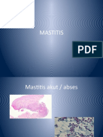 MASTITIS