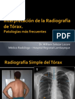 Interpretación de la Radiografía de Tórax: Principales Patologías