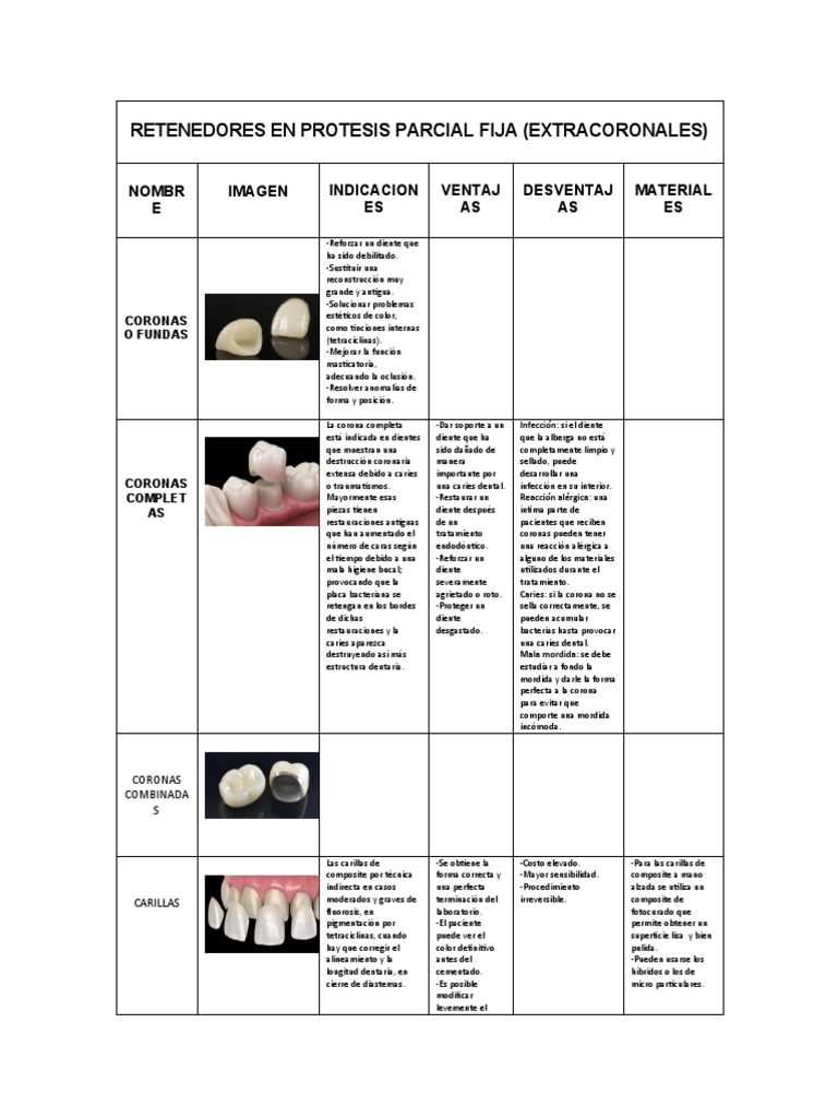 Retenedores en Protesis Parcial Fija | PDF | Dentadura postiza ...