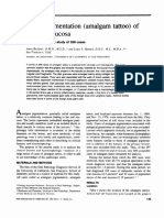 Amalgam Pigmentation (Amalgam Tattoo) of The Oral Mucosa: A Clinicopathologic Study of 266 Cases