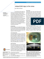 Forceps-Induced Birth Injury To The Cornea: Ruba Alobaidy, Sathish Srinivasan