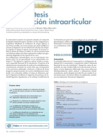Infiltracion Intraarticular