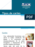 Caries 120506131100 Phpapp01 PDF