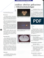 Resinas Acetálicas: Diversas Aplicaciones en Odontoestomatologta