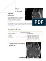 Osteosarcoma, Caso Clínico