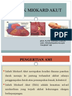 Infark Miokard Akut