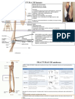 FRACTURA DE Humero