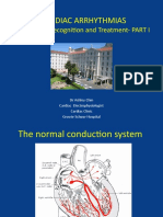 Cardiac Arrhythmias 6th Year