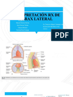 RX de Torax Lateral