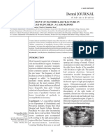 Dental JOURNAL: Management of Mandibular Fracture in 5 Year Old Child: A Case Report