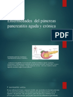 Pancriatitis