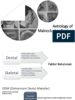 Aetiology of Malocclusion Review