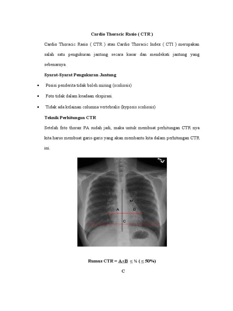 Pengukuran Cardio Thoracic Rasio (CTR) | PDF