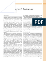 5 - Dupuytren's Contracture