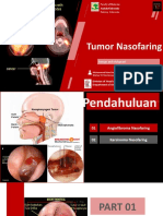 Angiofibroma Nasofaring, Tumor Benign Langka Pada Remaja Laki-Laki