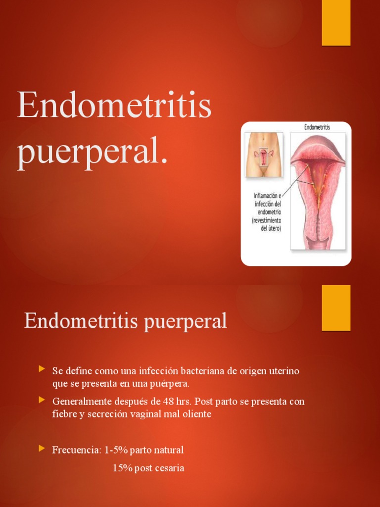 Endometritis Puerperal 1 PDF Parto Especialidades Medicas
