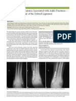 Deltoid Ligament Injuries Associated With Ankle Fractures - Argument For Repair of The Deltoid Ligament