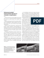 Ultrasound-Guided Hyaluronidase Injection in Cosmetic Complications