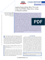 Successfully Managing Impending Skin Necrosis Following Hyaluronic Acid Filler Injection, Using High-Dose Pulsed Hyaluronidase