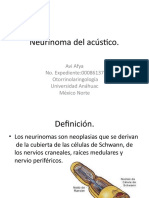 neurinomadelacstico-131102002911-phpapp02