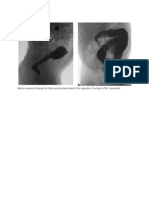 Item Q192B: Barium Enema Findings For The Neonate Described in The Vignette. Courtesy of M. Liszewski