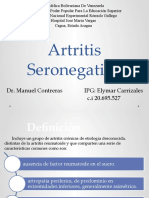 artritis seronegativa