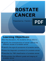 Prostate Cancer: Presented By: Franklin Que, BSN-RN