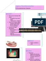 Principios Fundamentales de Las Preparaciones Dentales en PPF