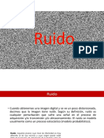 Ruido de Imagen