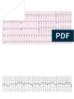 Latihan EKG