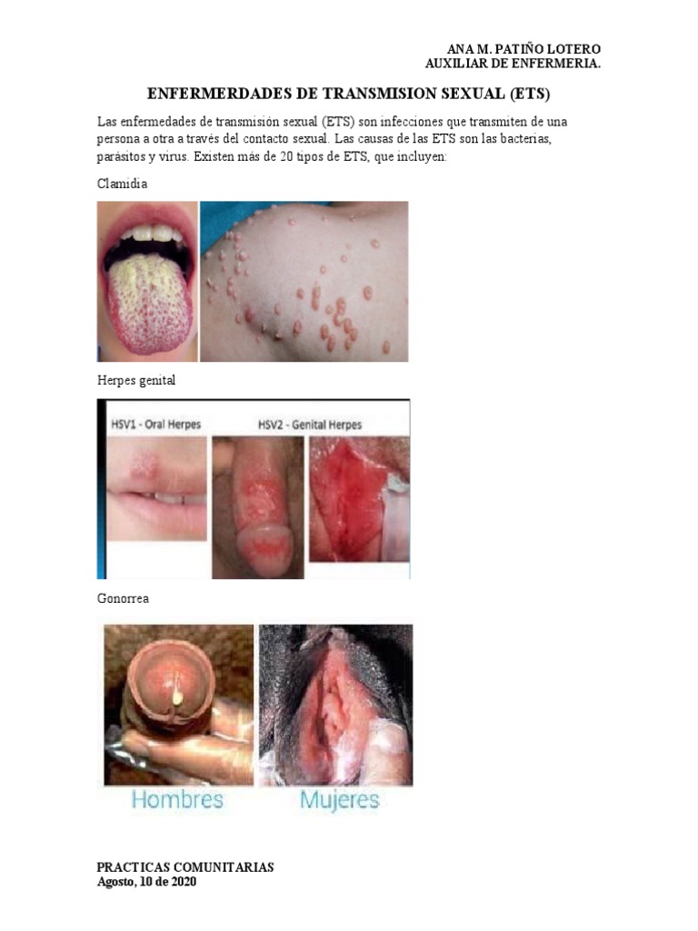 Enfermedades de Transmisión Sexual (ETS) | PDF | Infección transmitida  sexualmente | Herpes Simple, image size:768x1024