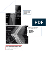 Pretest Orthopedi